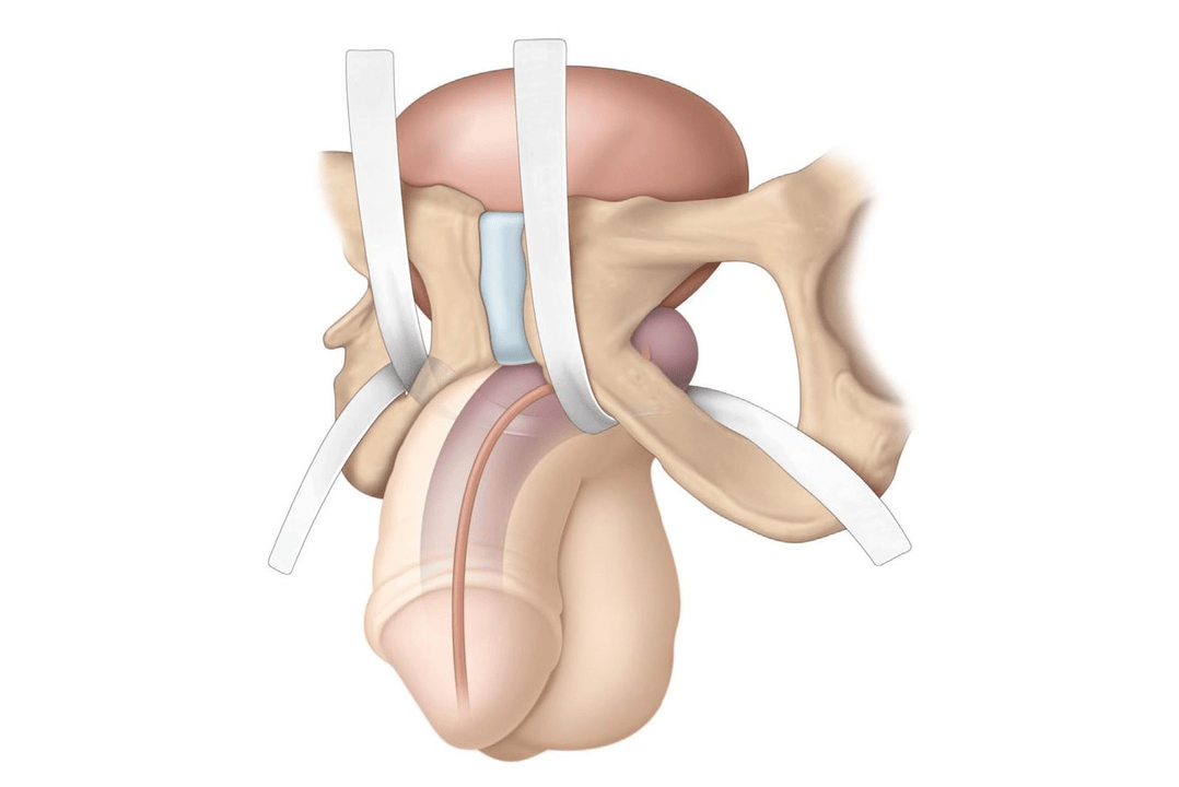 locations being investigated for the presence of fillers