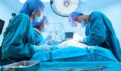 An increase in surgery on experts